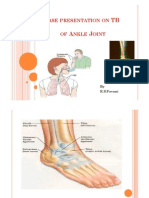 Tuberculosis of Ankle Joint