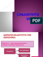 Conjuntivitis Virales