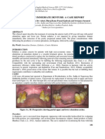 Maxillary immediate denture case