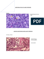 Gambar Prakt PA - Neoplasma