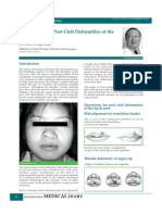 Manage Post-Cleft Lip & Nose Deformities