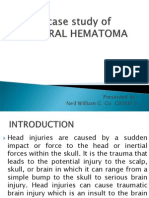 A Case Study of Epidural Hematoma