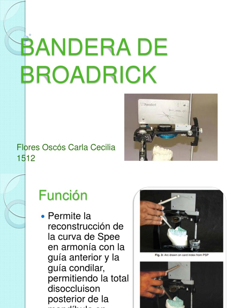 Análisis del Plano Oclusal Broadrick | PDF