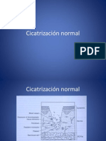 Cicatrización normal y patológica