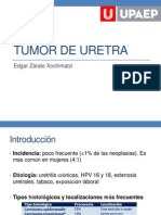 Tumor de Uretra