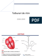 Tulburari de Ritm VI - VII