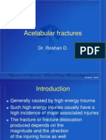 Acetabular Fractures: Dr. Roshan D