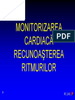 Monitorizarea-cardiaca