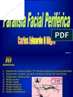 Paralisia+Facial+PerifÃƒÂ©rica