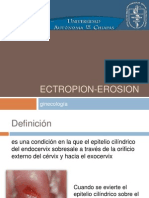 Ectropion Erosion