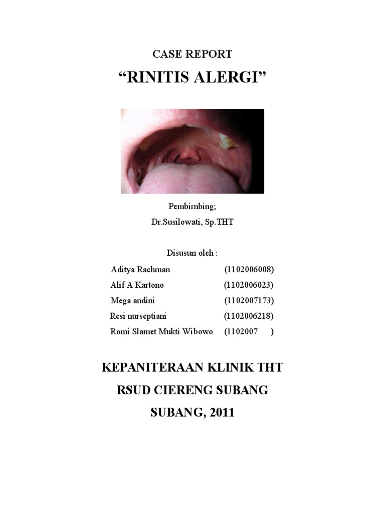 Case Report: Allergic Rhinitis | PDF