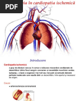 Kinetoterapia in Cardiopatia Ischemica