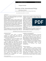 Endoscopic Excision of Antrochoanal Polyp