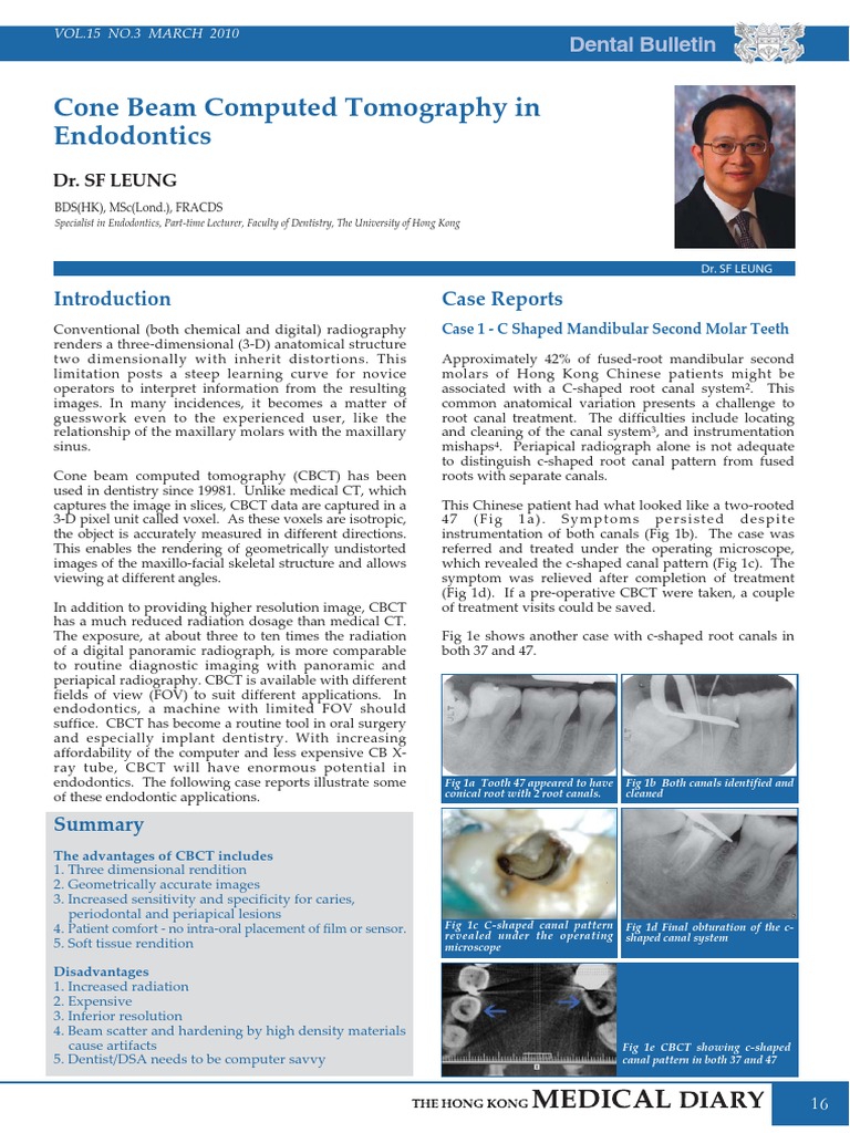 Cone Beam Computed Tomography in Endodontics (Inglês) | PDF | Science ...