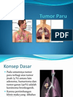 Tumor Paru