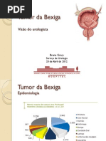 Tumor Da Bexiga