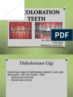 Discoloration Teeth