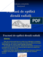 Fractura de Epifiză Distală Radială