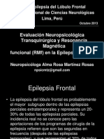 Epilepsia Frontal