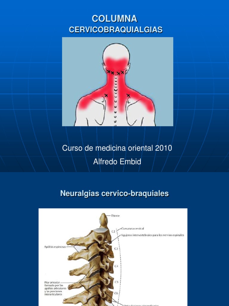 CERVICOBRAQUIALGIAS 2 - C | PDF