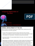 Congenital Malformation of The Brain: By: Myra Leslie S. Viloria References: Neuroimaging - Clinical Applications
