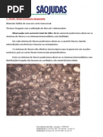 07 - Tecido Ósseo Compacto desgastado