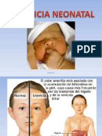 10. ICTERICIA NEONATAL2