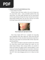 Download Manifestasi Oral Dari Penyakit Infeksi Karena Virus by nisa milati biyantini SN20853525 doc pdf