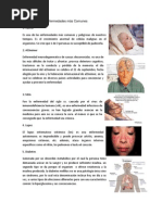 10 Enfermedades más Comunes