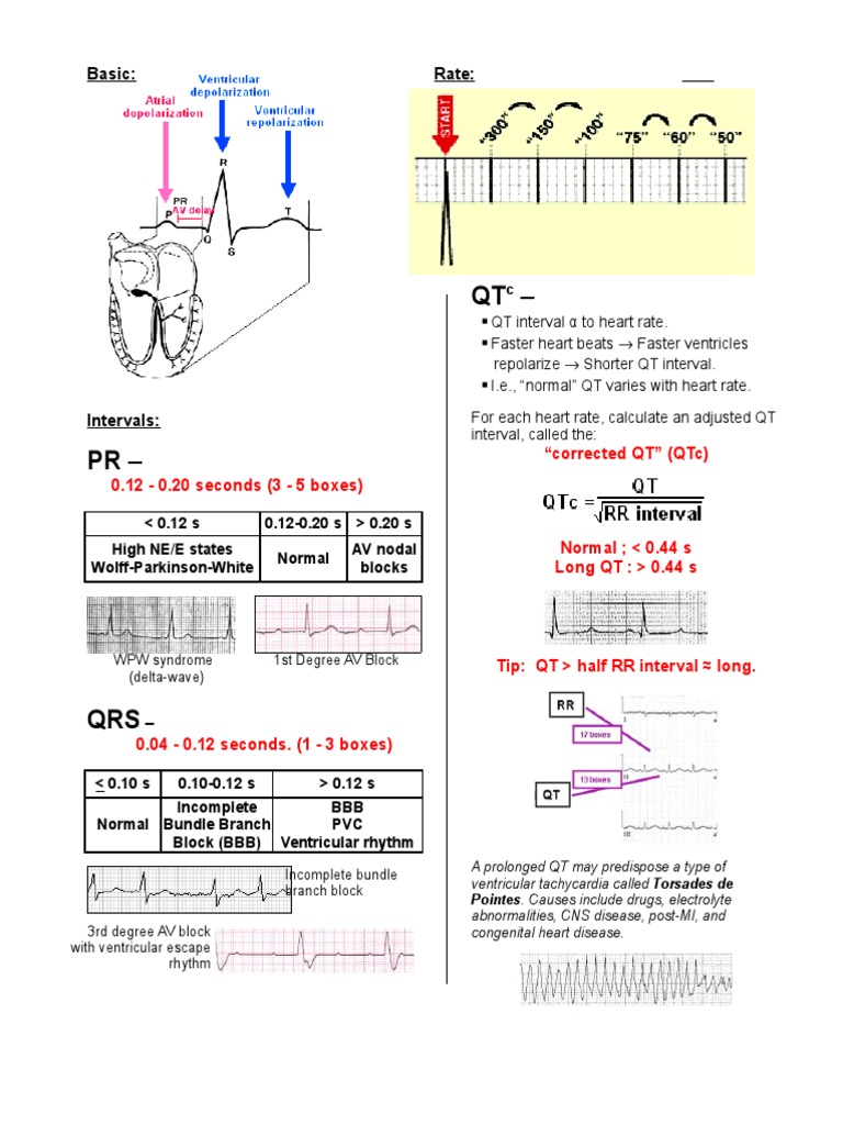 A Simplified ECG Guide | PDF | Cardiovascular Diseases | Cardiovascular ...