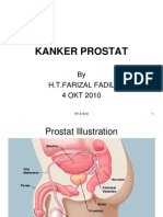 Presentation1, Prostat Cancer