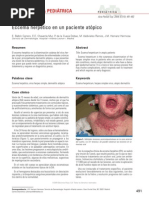 Dermatologia_Eccema