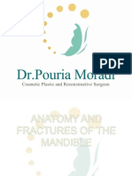 Anatomy and Fractures of the Mandible 