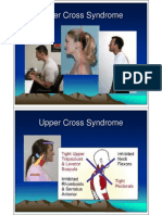Upper Cross Syndrome Dr. Jeff Luebbe 2-05-12