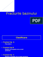 03 - Fracturile de Bazin