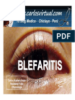 Blefaritis 091018112016 Phpapp01