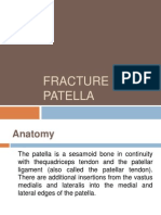 Fracture of Patella