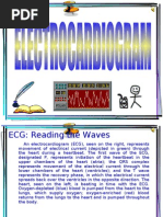 Download ECG Reading the Waves by james garcia SN20930105 doc pdf