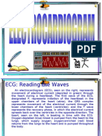 ECG: Reading The Waves