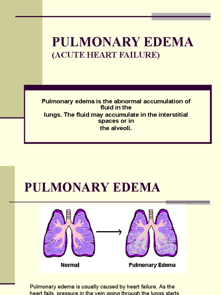 Heart Failure and Pulmonary Edema | PDF | Heart | Edema