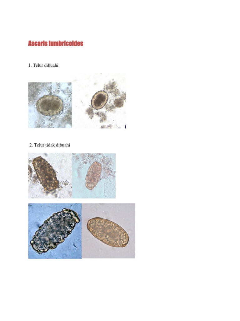 OSCE Diagnostic Feses | PDF