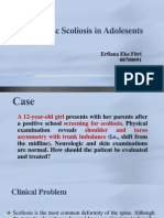 Idiopathic Scoliosis in Adolesents