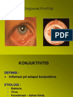 Konjungtivitis