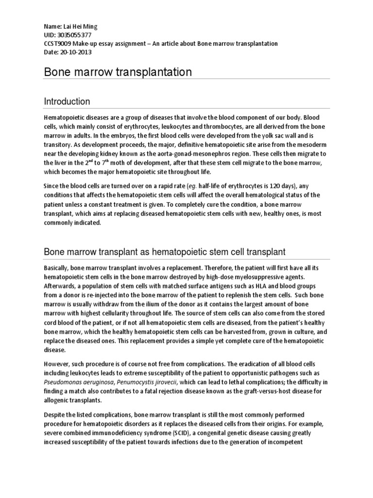 How to cook bone marrow image