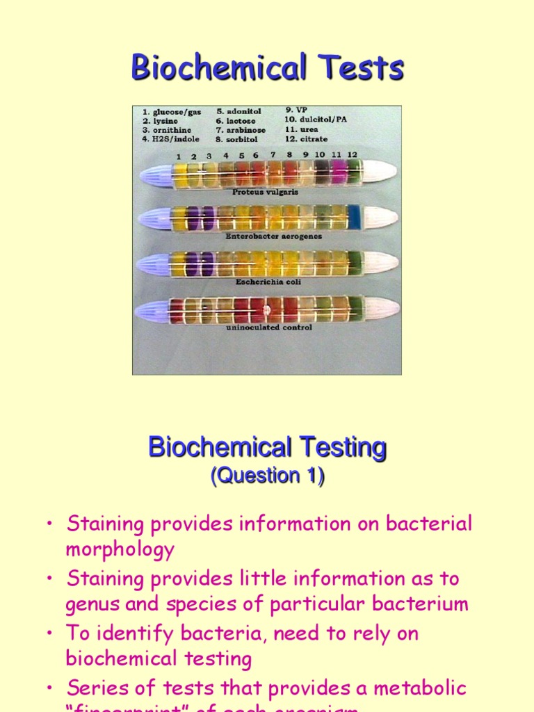 Biochemical Testing for Bacteria Identification | PDF | Biochemistry ...