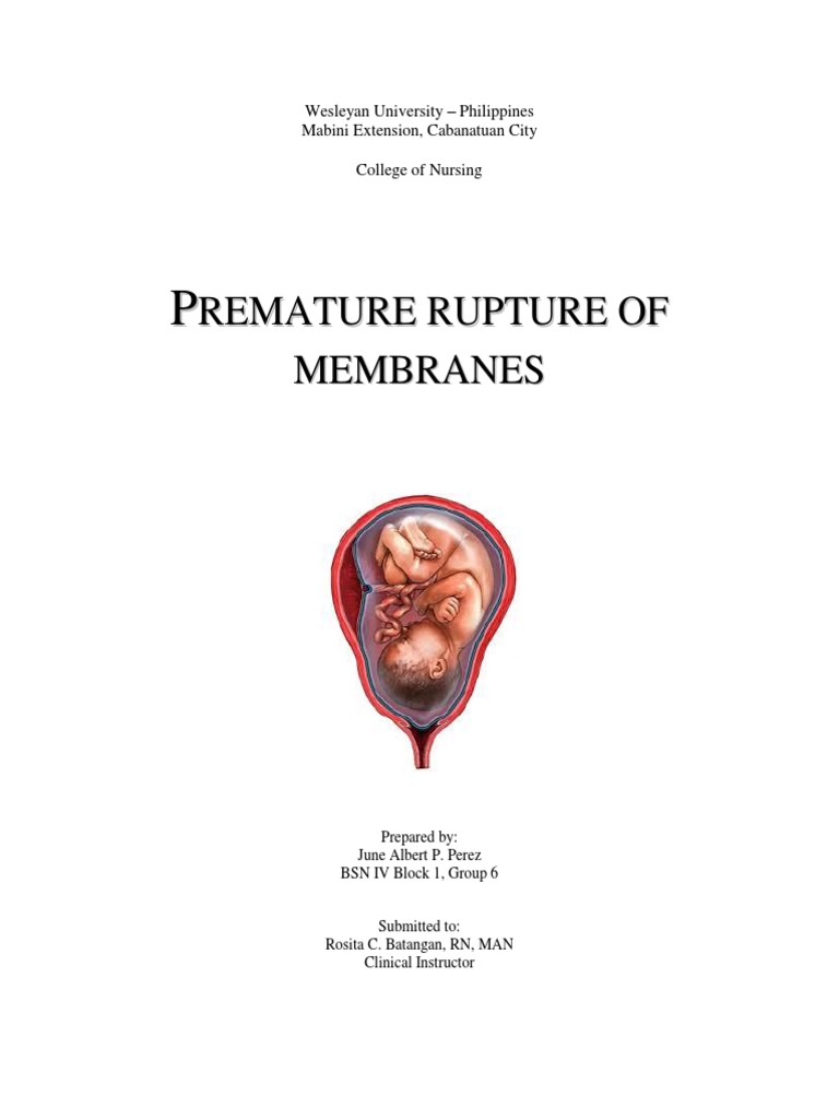 Premature Rupture of Membranes Preterm Birth Childbirth
