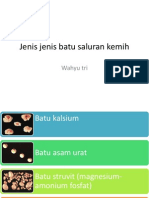 Jenis Jenis Batu Saluran Kemih