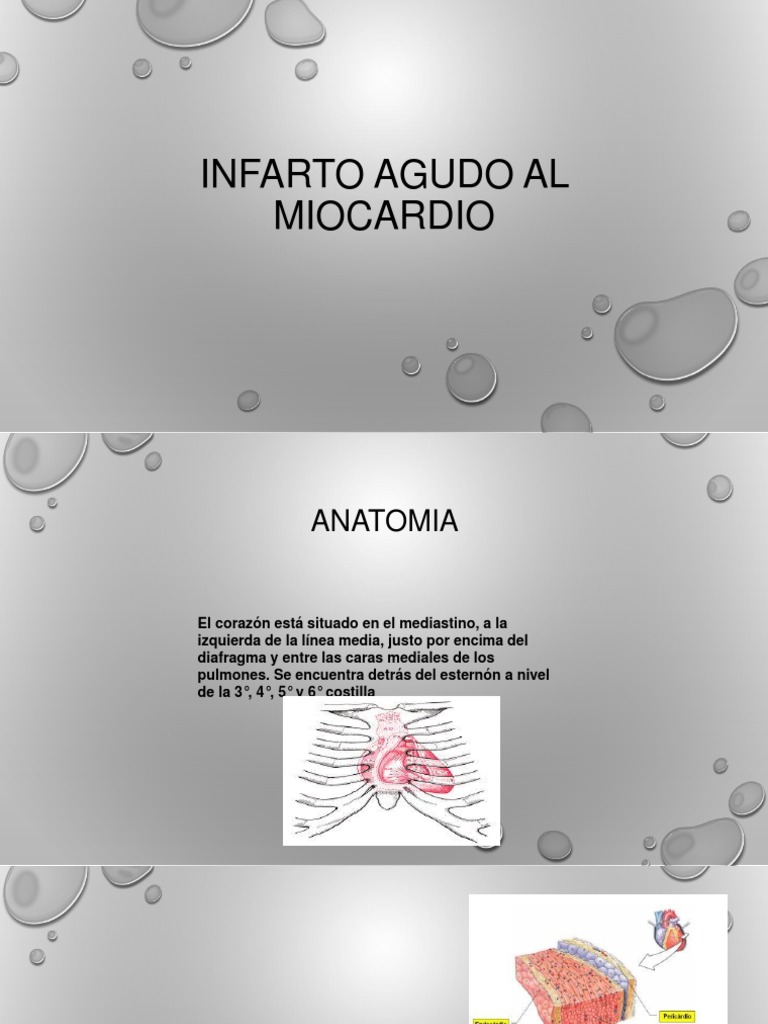 Infarto Agudo Al Miocardio | PDF | Corazón | Angina de pecho