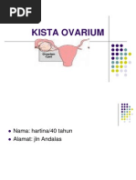 Download KISTA-OVARIUMppt by Karisma Nanda SN210774706 doc pdf