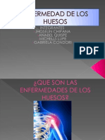 Enfermedad de Los Huesos